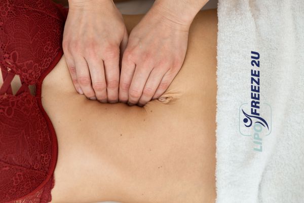 diastasis recti treatment Coatbridge