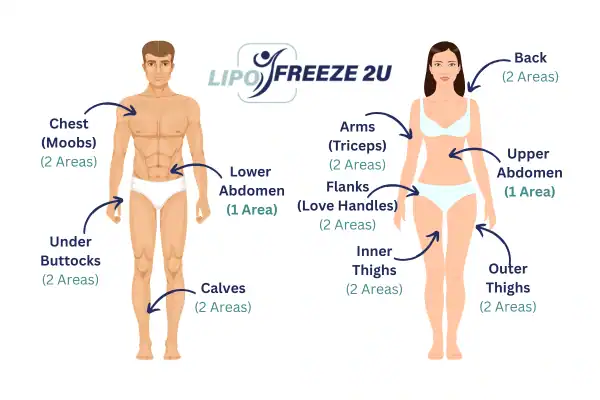 Areas you can have fat freezing treatment Coatbridge