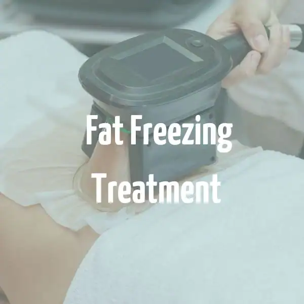 fat freezing treatment Coatbridge