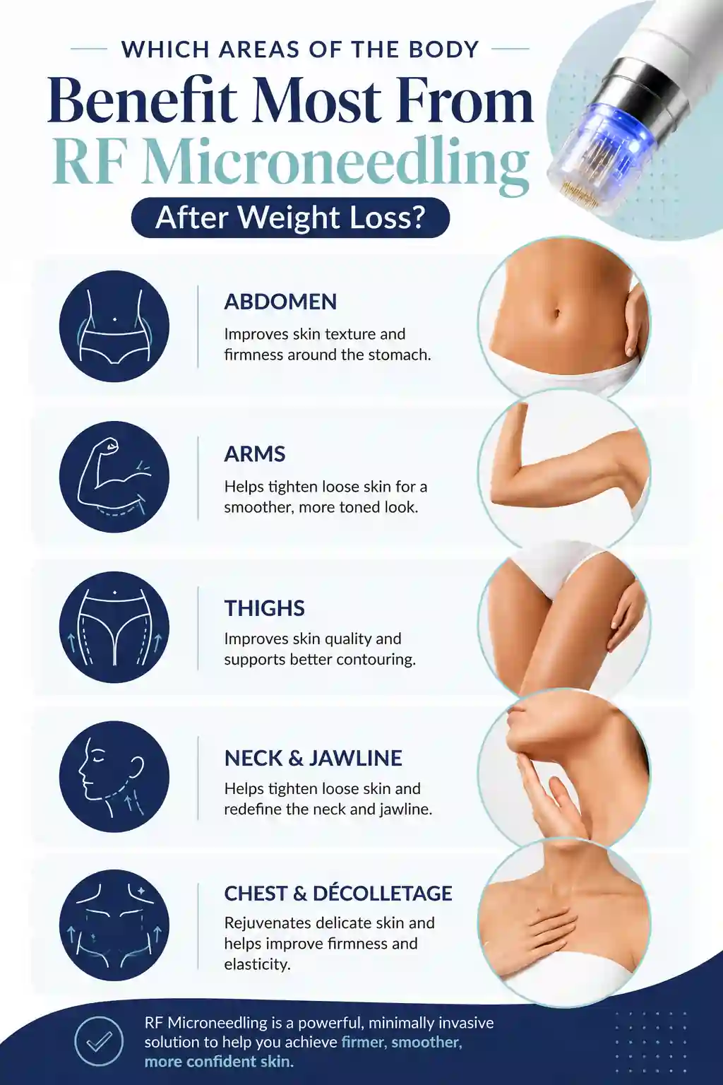 Which Areas of the Body Benefit Most From RF Microneedling After Weight Loss Coatbridge