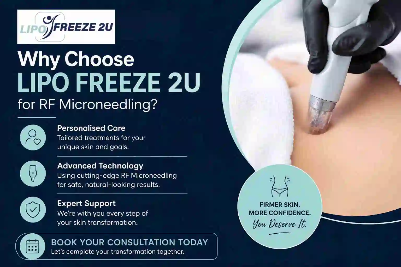 Why Choose LIPO FREEZE 2U for RF Microneedling Coatbridge?